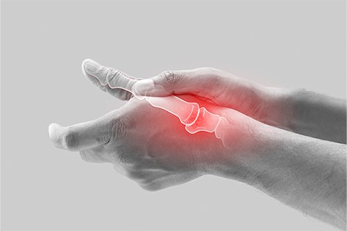 Gout Patient Monitoring Pane